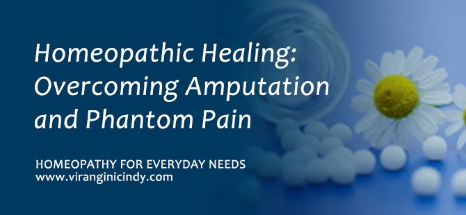 Amputation